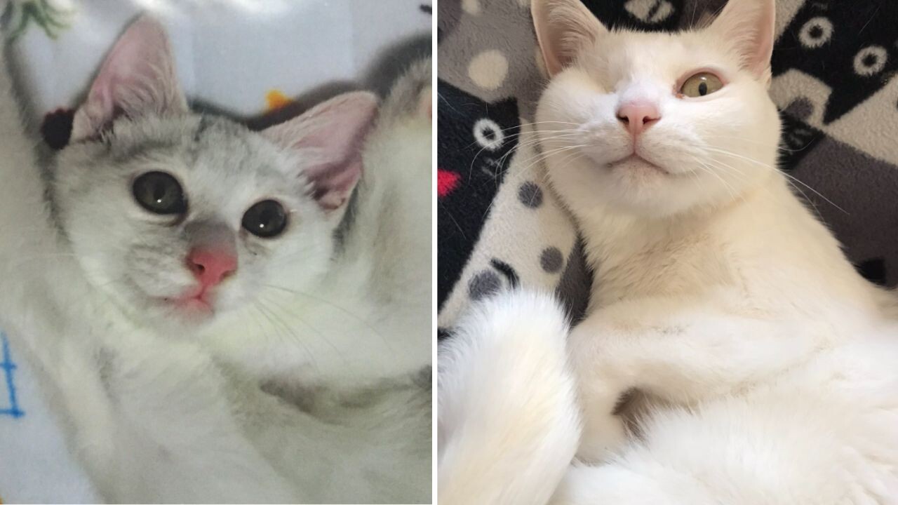 ある日突然、目に「シミ」のような模様ができて…眼球摘出手術を